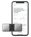 Single Lead EKG B922851